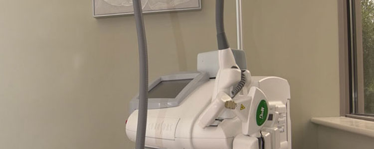 Cynosure ICON Laser